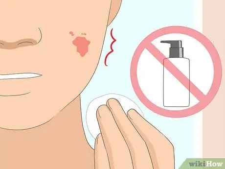 Лечить аллергическую реакцию на лице Шаг 14