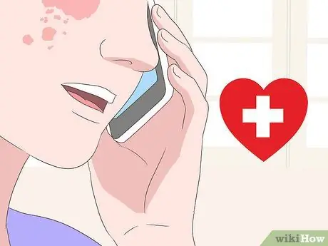 Лечить аллергическую реакцию на лице Шаг 6