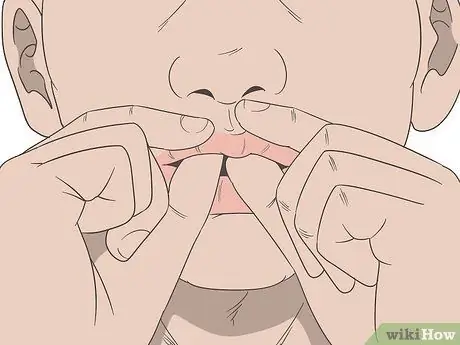 Уменьшить отек губ с помощью инъекций Шаг 10