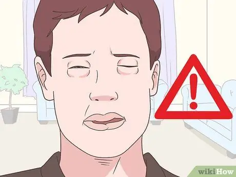 Избавьтесь от онемения губ Шаг 12