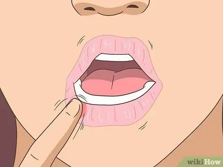 Избавьтесь от онемения губ Шаг 4