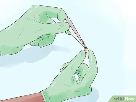 Вставьте суппозитории с борной кислотой Шаг 12