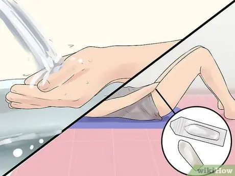 Вставьте суппозитории с борной кислотой Шаг 3