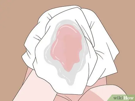 Определите разницу между менструацией и выкидышем Шаг 4