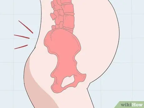 Определите разницу между менструацией и выкидышем Шаг 7