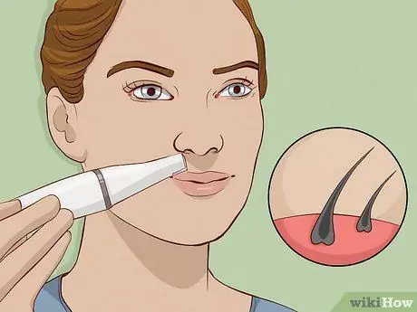 Эпиляция волос на лице Шаг 7