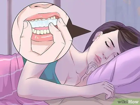 Используйте гель для отбеливания зубов, шаг 12