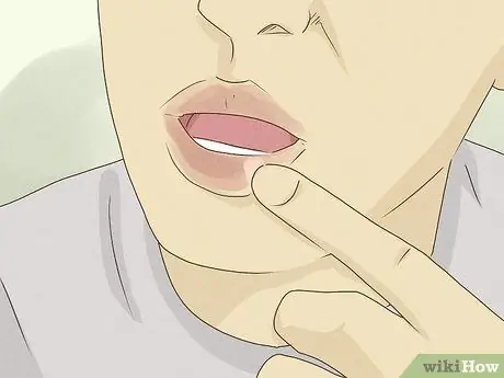 Исцелить губы после укуса Шаг 2