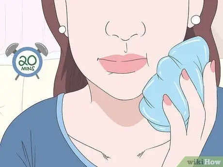 Уменьшить отек зуба мудрости Шаг 2