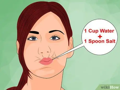 Облегчить боль в зубах мудрости Шаг 5