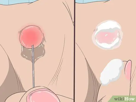 Нанесите Moleskin Step 1