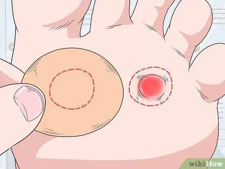 Нанесите Moleskin Step 7