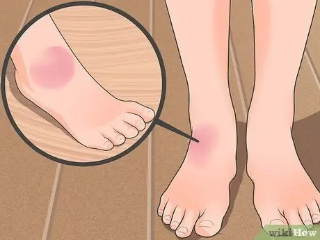 Как определить, сломана ли нога Шаг 3