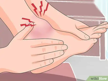 Как определить, сломана ли нога Шаг 4