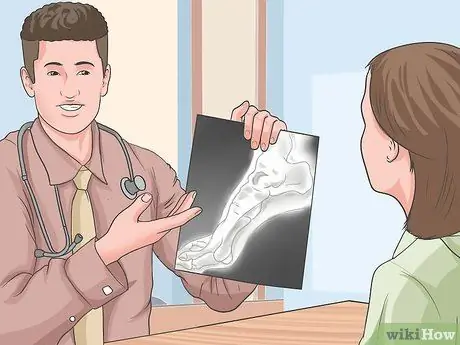 Как определить, сломана ли нога Шаг 7