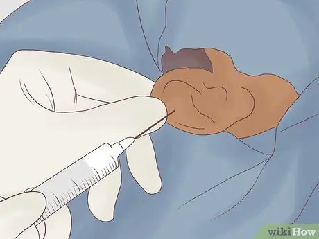 Исцеление растянутых отверстий для серег, шаг 4