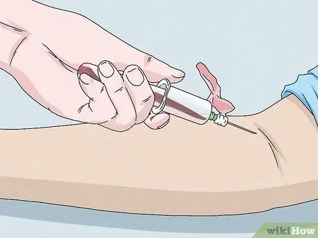 Предотвратить эозинофильный эзофагит Шаг 18