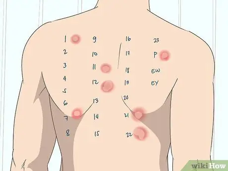 Успокойте пищевод Шаг 20