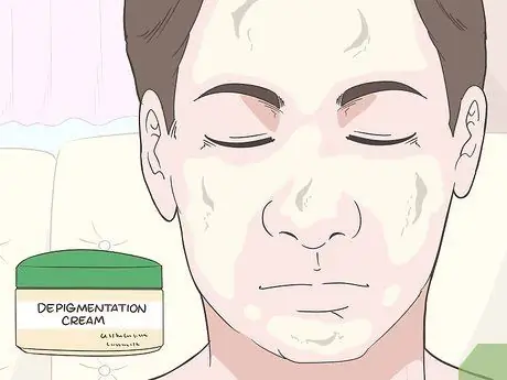 Как предотвратить ухудшение состояния витилиго Шаг 9