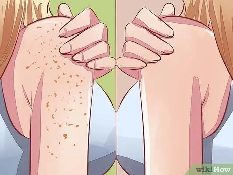 Избегайте пигментации кожи во время беременности Шаг 12