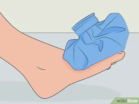 Быстро залечить ушибленный ноготь на ноге, шаг 01