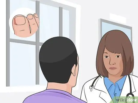 Быстро вылечите ушибленный ноготь на ноге, шаг 15