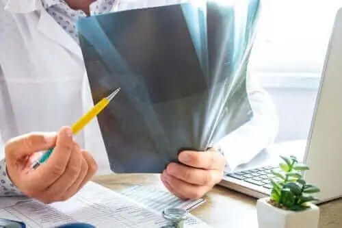 Все, что вам нужно знать об отеке костного мозга