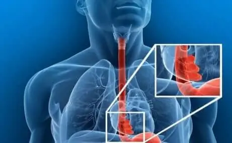 Изображение пищевода