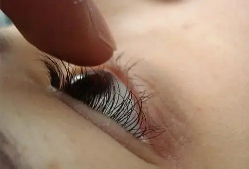 Инсульт быстрый тест