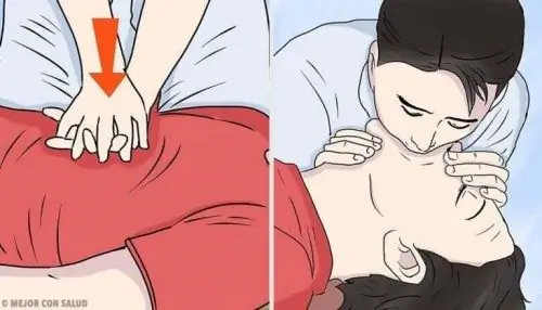 Объясните СЛР