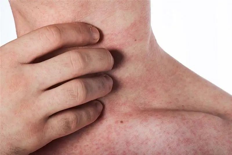 Кожа бабочки