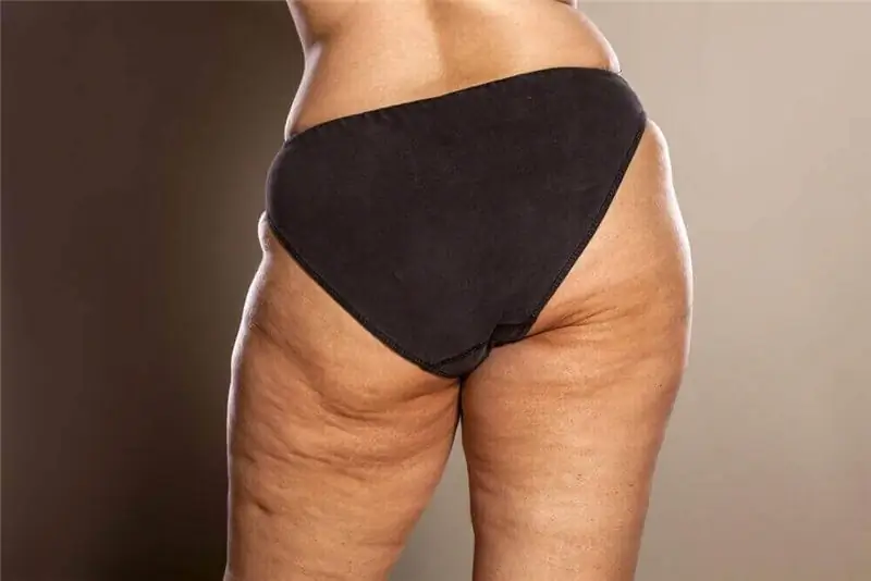 План антицеллюлитной диеты