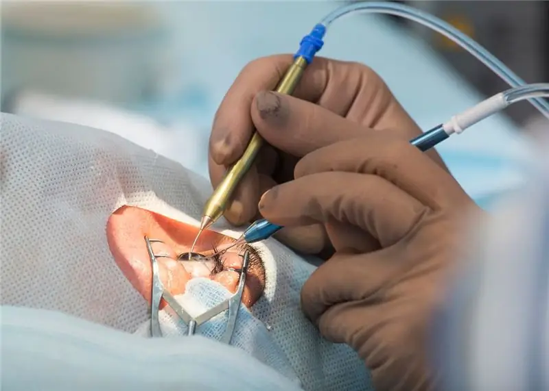 Хирургия глаза