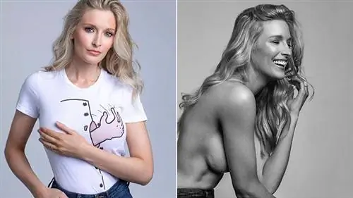 Вдохновляющие-женщины-пострадавшие-от-рака-молочной железы-следить-в-Instagram-10-AllynRose-722x406