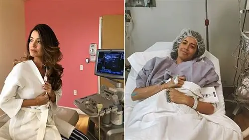 Вдохновляющие женщины, затронутые раком молочной железы, чтобы подписаться на Instagram-04-AlejandraCampoverdi-722x406