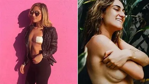 Вдохновляющие-женщины-пострадавшие-от-рака-молочной железы-следить-в-Instagram-08-PaigeMoore-722x406