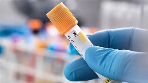 Что нужно знать о тестировании на ВИЧ