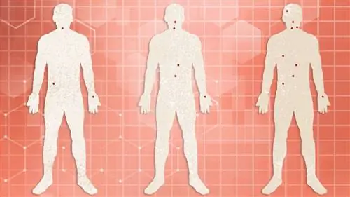 A-хронология-симптомов-ВИЧ-1440x810