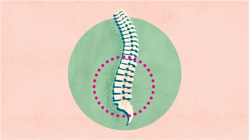 Что такое анкилозирующий спондилит (АС)? Симптомы, причины, диагностика и лечение