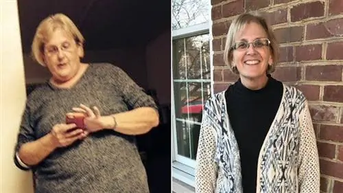 Тина Маркус, женщина, которая похудела после того, как ей поставили диагноз диабет