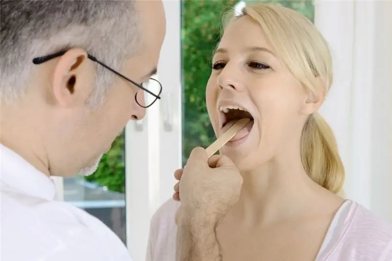 Следует обратиться к врачу, если дискомфорт на небе сохраняется. (Изображение: Дэн Рэйс - fotolia)