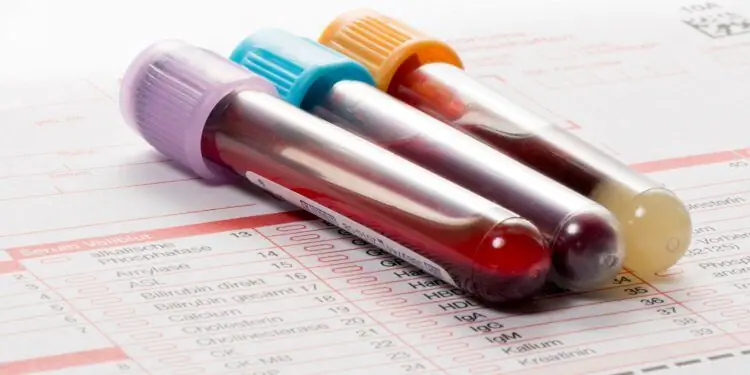 Три пробирки с кровью лежат на листе анализа