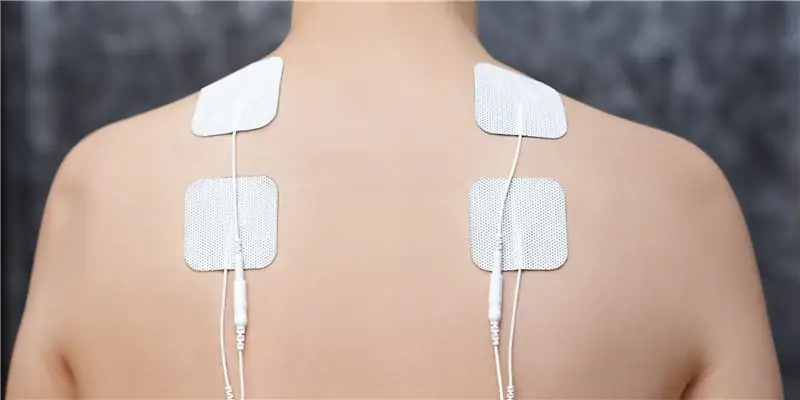 Электростимуляционная терапия – применение и эффект