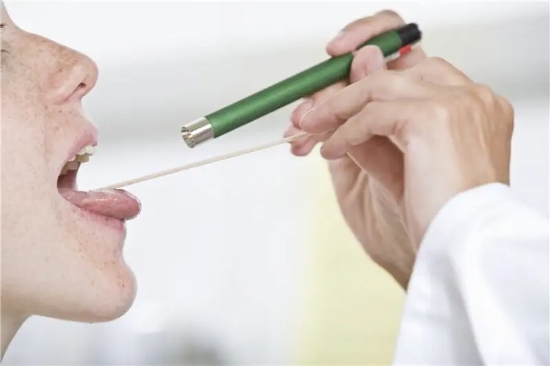 Rödern (лечение Редера) – удаление камней миндалин