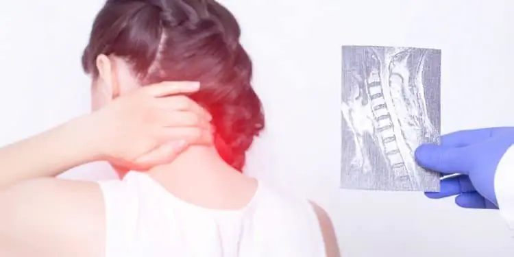 Женщина держит руку на больной шее, а рядом с ней другой человек держит рентгеновский снимок шейного отдела позвоночника