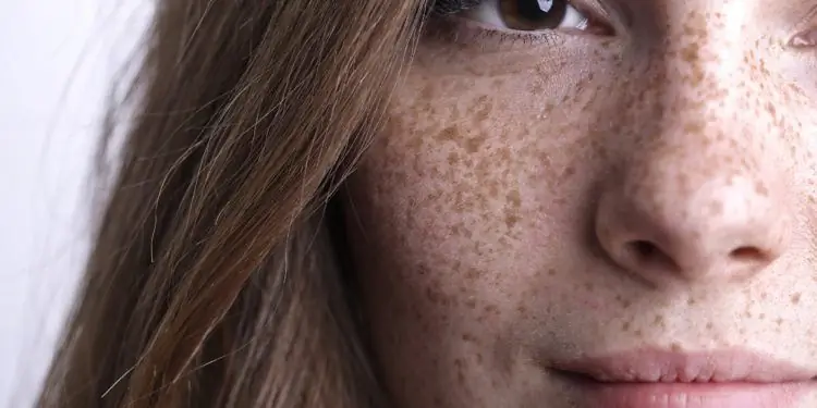 Крупный план правой стороны женского лица с множеством веснушек