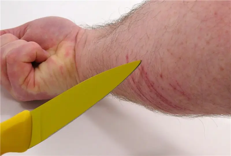 Трещины – причины, лечение, симптомы