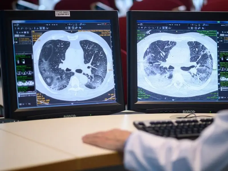 Восстановление после COVID-19: как люди справляются после болезни