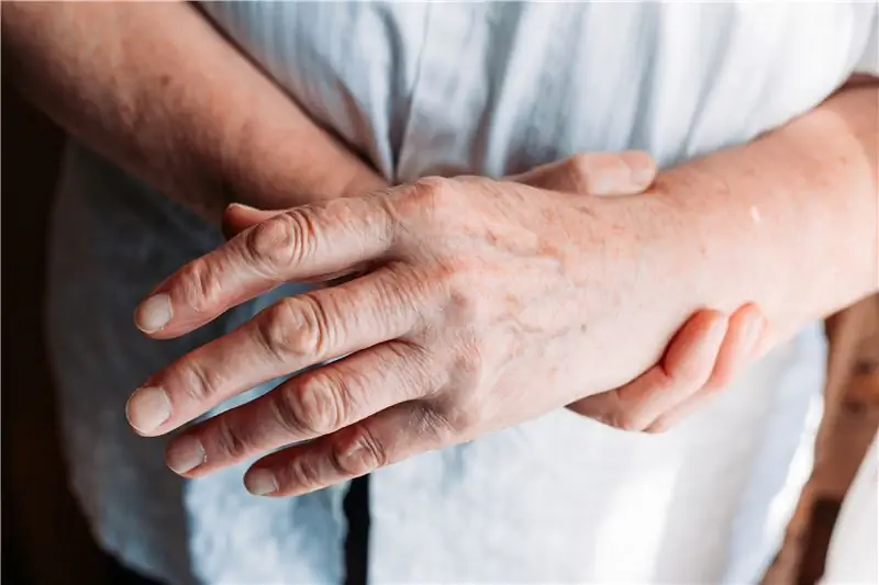 Коронавирус: продолжайте принимать лекарства от ревматизма