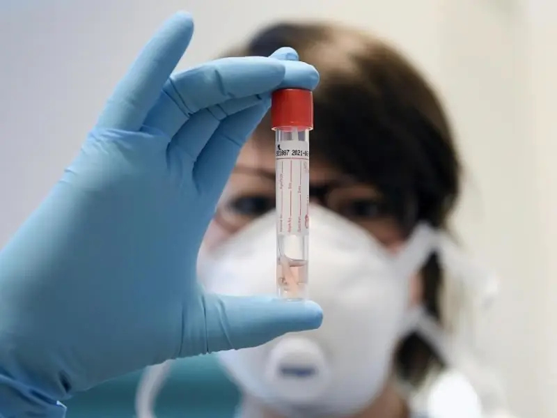 Тест на коронавирус: долгое время ожидания из-за перегруженных лабораторий